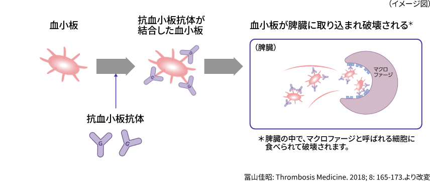 ITPの症状